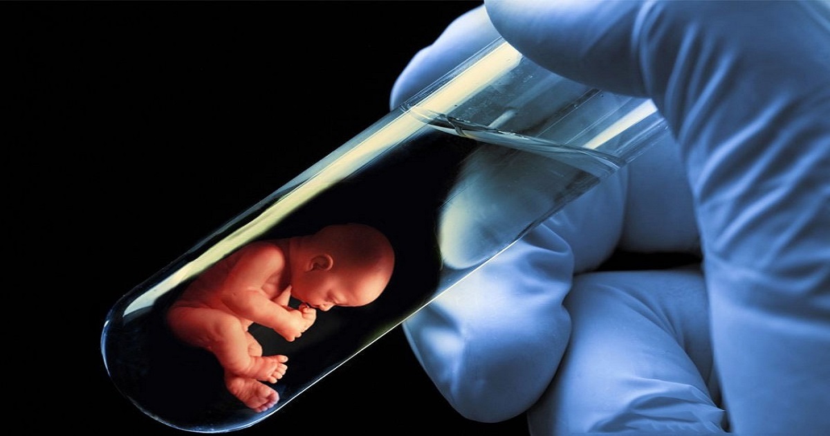 IVF Test Tube Baby